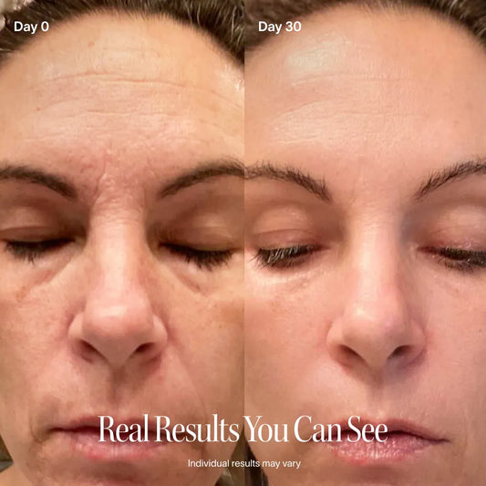 LUMINA Red Light Therapy Wand for Face and Neck